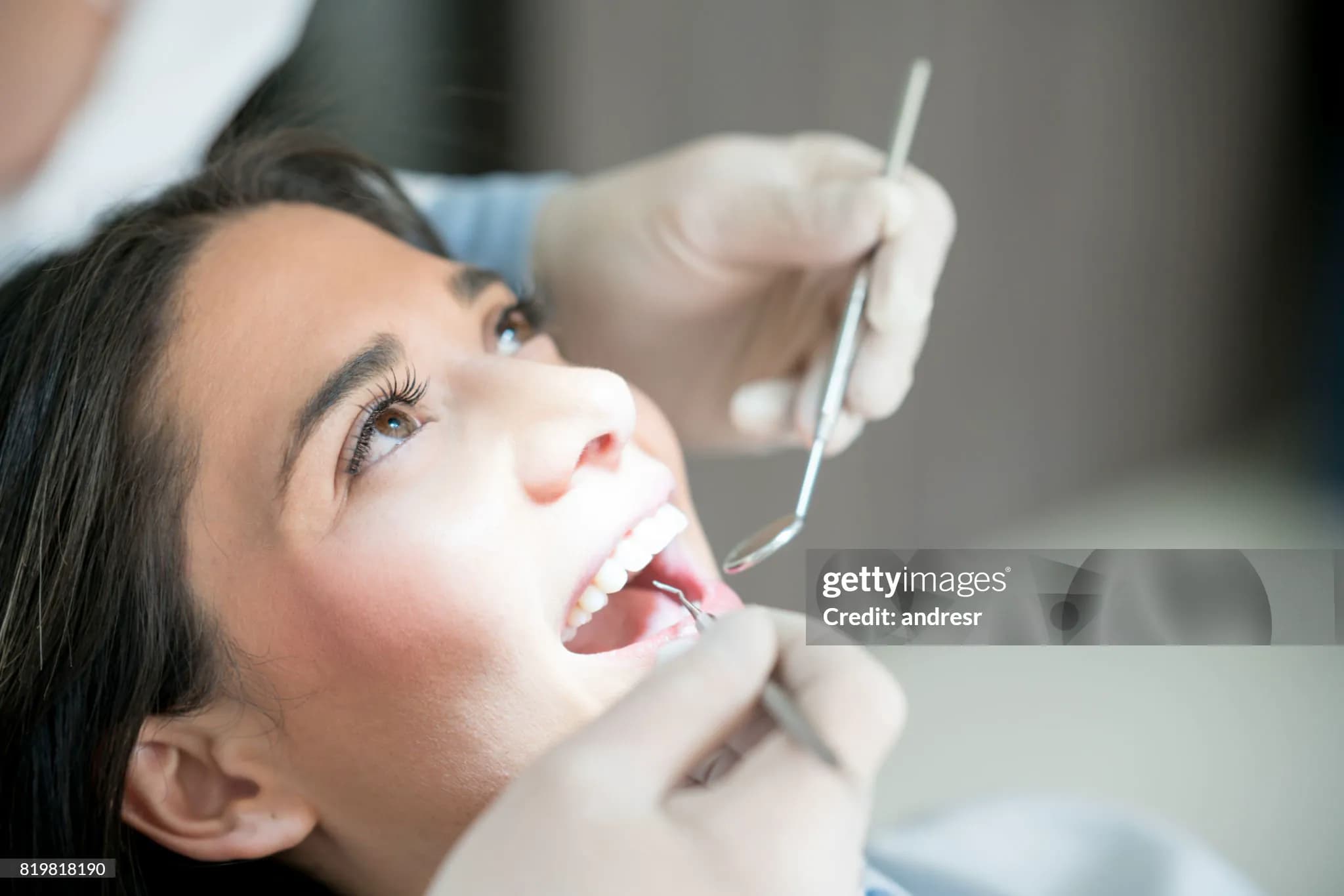 Procedimiento profesional de limpieza dental