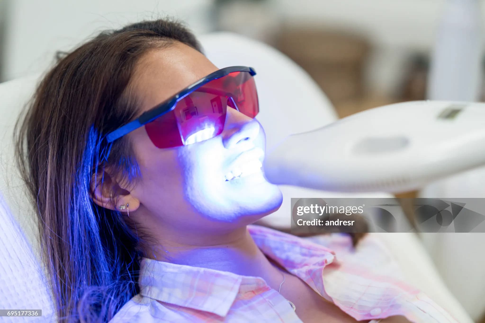Resultado de tratamiento de blanqueamiento dental